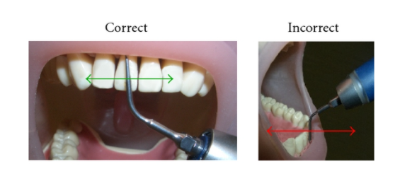 R4423`PUNEGD) XDFORW